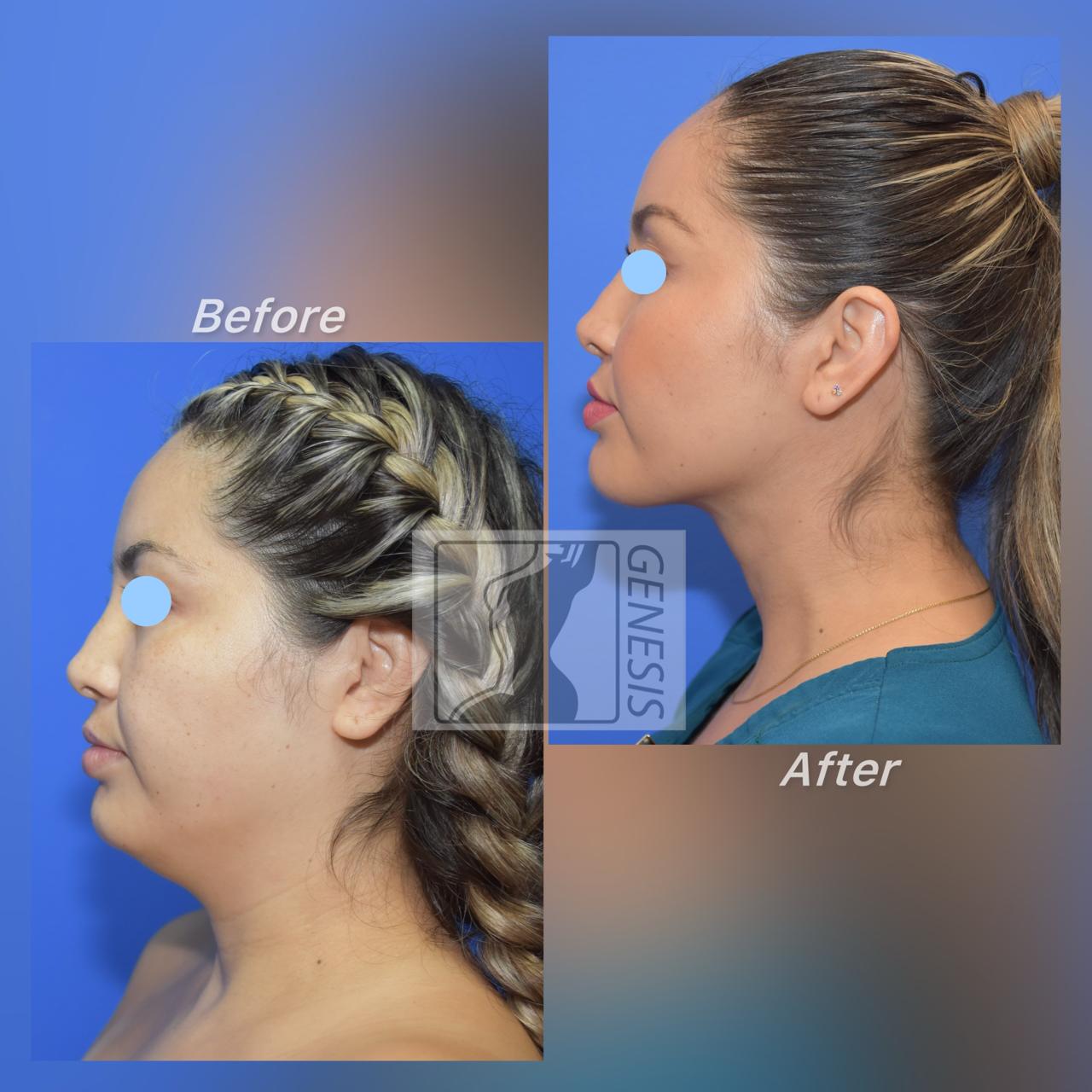 Jaw, Chin, and Neck Detailing